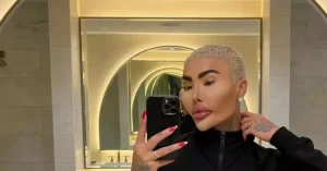 Reality TV Star Jordan James Parke Known as “Lip King” Dies at 36!