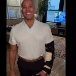 What Happened to Mike Woods arm